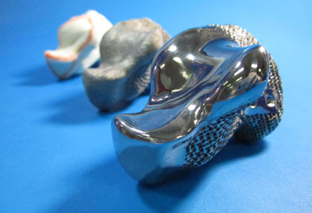 3D Printed Talus Replacement